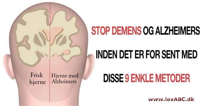 Stop demens og alzheimers med 9 vaner som beskytter dig